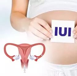 Intrauterine Insemination In Iran Iui Treatments Ermateb