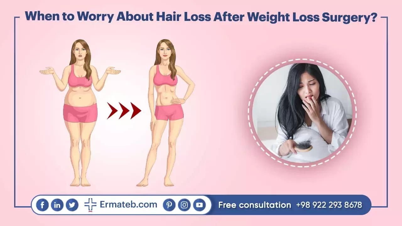 When to Worry About Hair Loss After Weight Loss Surgery?