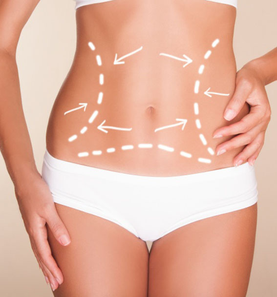 What are the Side effects of Liposuction