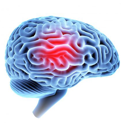 Preventing the long-term effects of TBI
